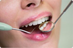 Todo lo que tienes que saber sobre la salud bucodental